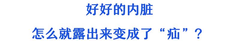 “大爷，你的肠子怎么老往外掉？”
