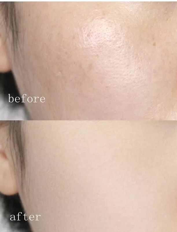 有了它们，你就可以过个美美的夏天啦