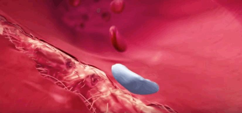 血小板破裂是什么意思,血小板凝固原因