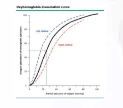 柯敬东教授：产科大出血的救治