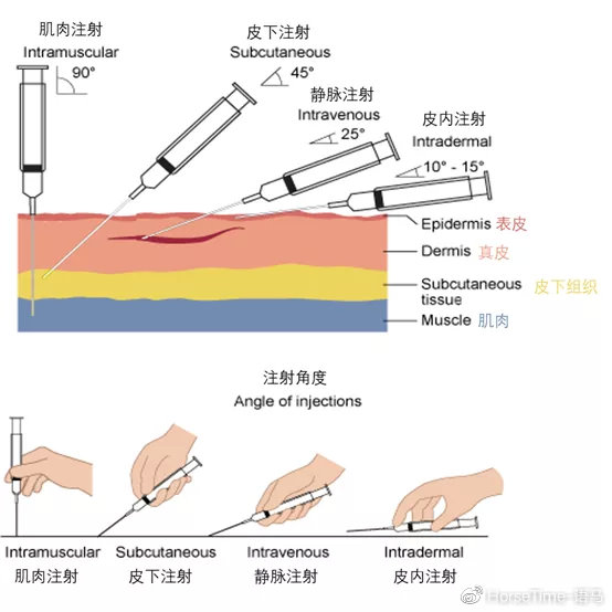 这针扎在马脖子上，还分皮下针和肌肉针？