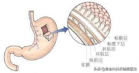 早上喝粥养胃还是晚上喝粥养胃,喝粥不养胃那到底吃什么养胃