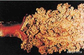 牛瘤最有效的治疗方法,牛瘤病怎么治