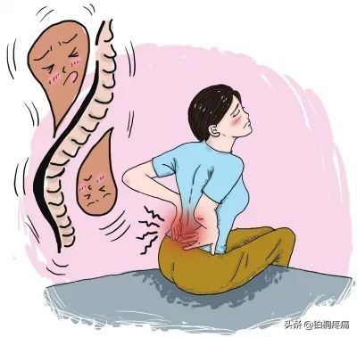 腰痛反反复复，一到天冷就发作，腰肌劳损该如何应对？