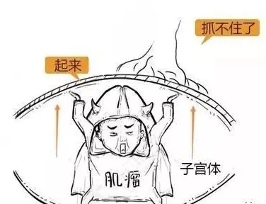 子宫肌瘤动漫演示,子宫肌瘤是什么原因导致的漫画