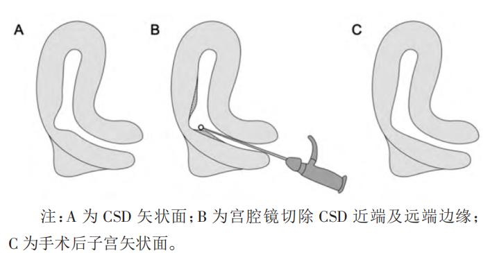 两个大头宝宝，让我经历了两次剖宫产
