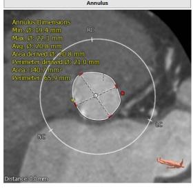 罗建方医生怎么样,罗建方教授