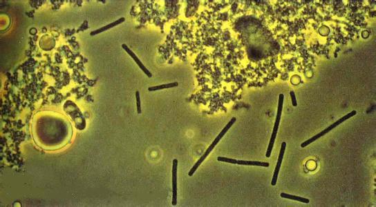 水产养殖培菌作用,水产养殖为什么要养菌