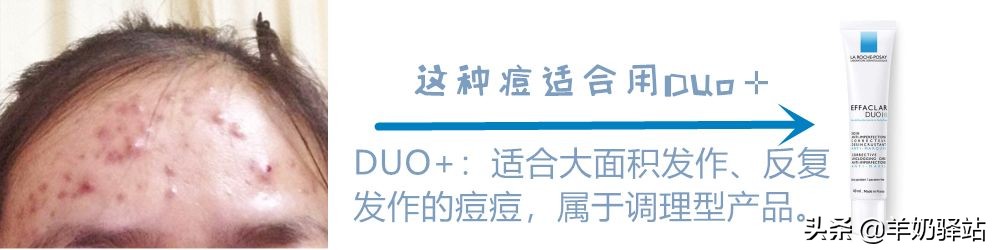 雅漾理肤泉哪个保湿补水效果好,药妆护肤品真的可靠吗