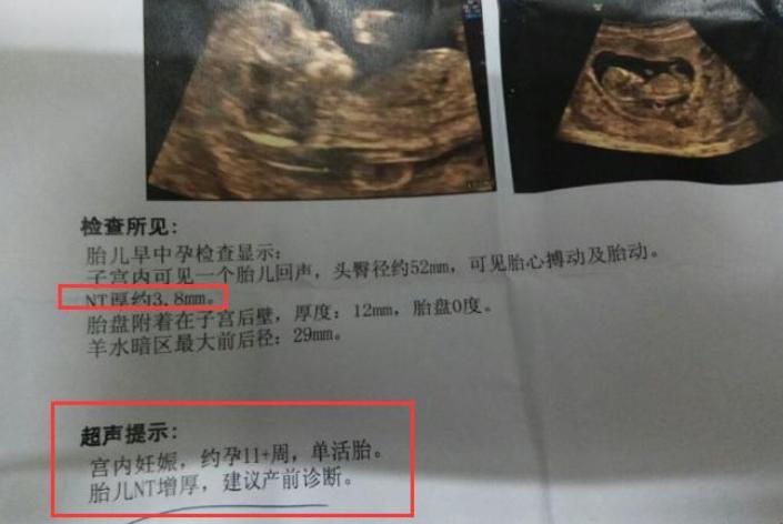 有什么好办法确定怀孕,要怎么确定怀孕