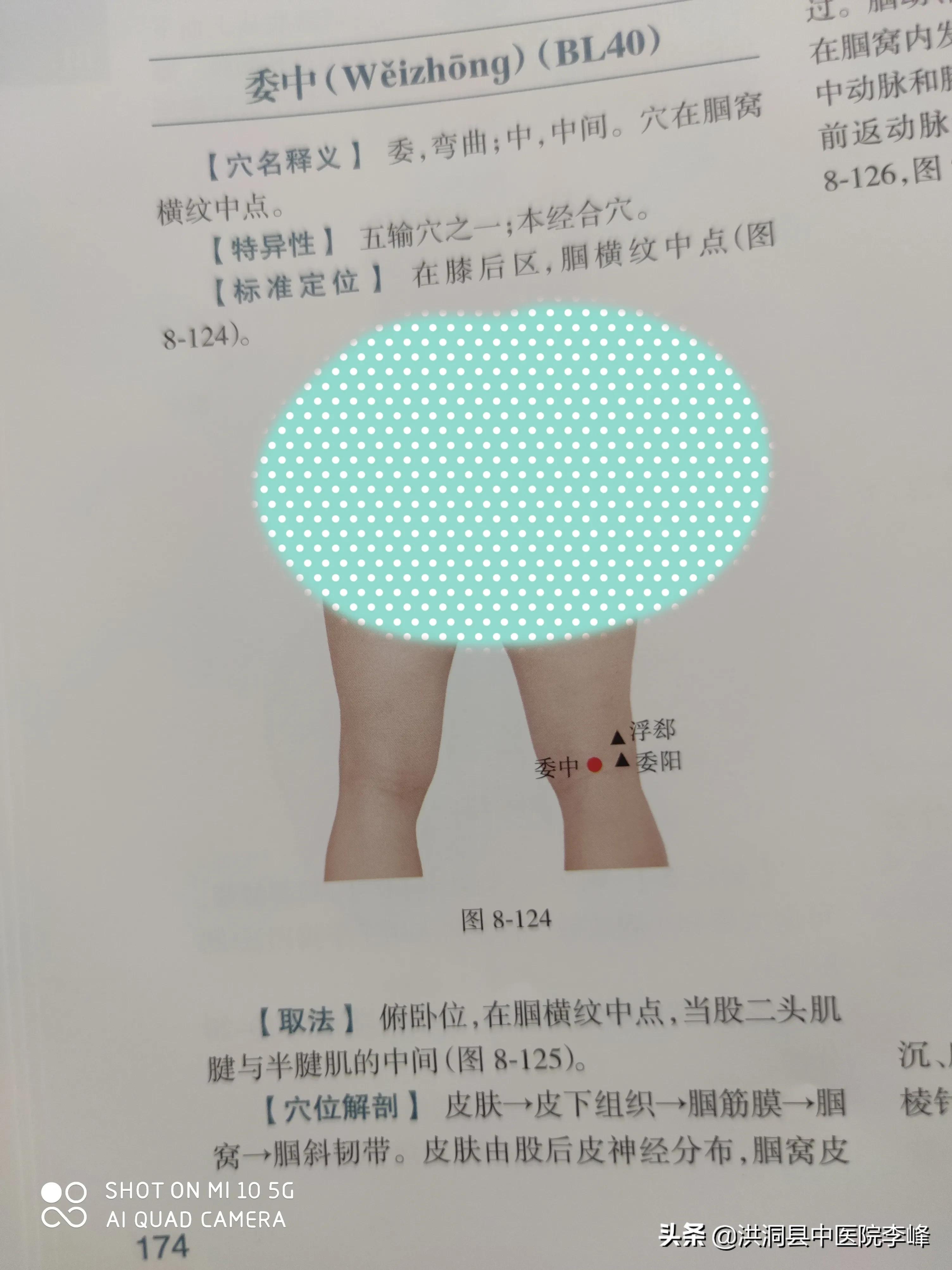 常见痛症“针刺运动疗法”特定取穴