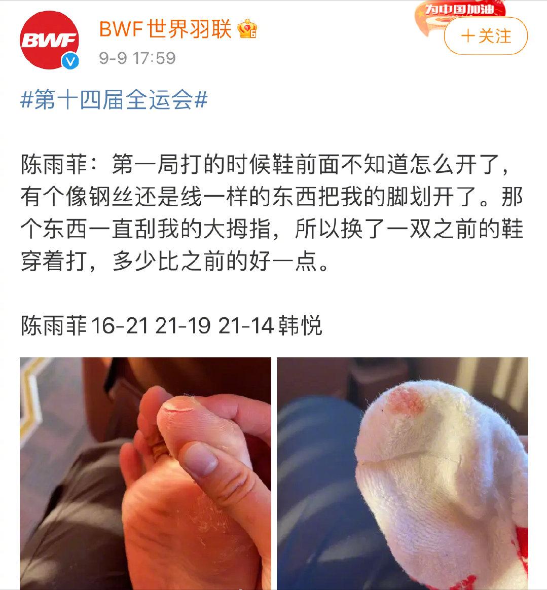 奥运冠军被李宁鞋割伤,鞋头崩开钢丝割脚,1099元的鞋就这质量?