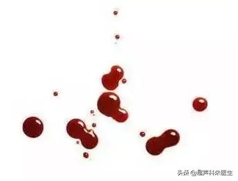 内裤上面很黄是妇科炎症吗,内裤暗藏妇科病