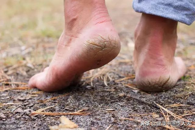嘴唇干裂脚后跟干裂脱皮缺乏什么,生完孩子后为什么脚后跟干裂脱皮