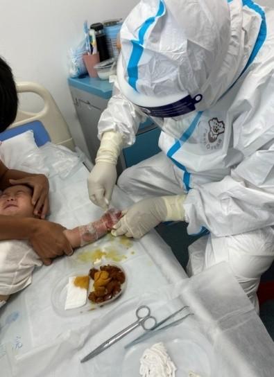 触目惊心，婴儿被热水烫伤，太揪心。如何规避和处理烫伤问题呢？