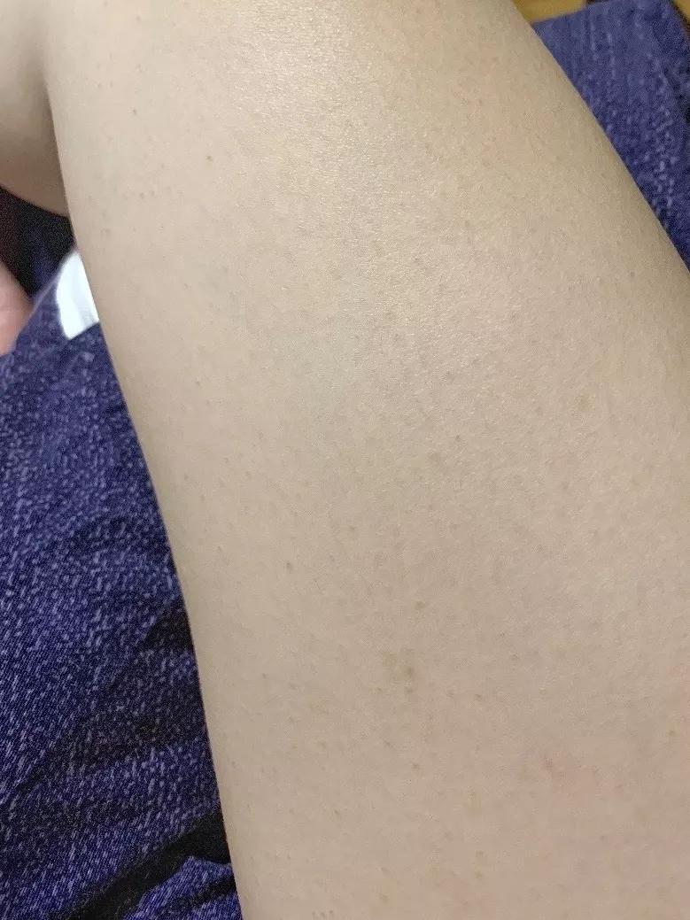 皮肤怎么变光滑柔和,皮肤怎么变光滑没有小疙瘩