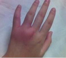 寒冷预警15度,寒冷黄色预警