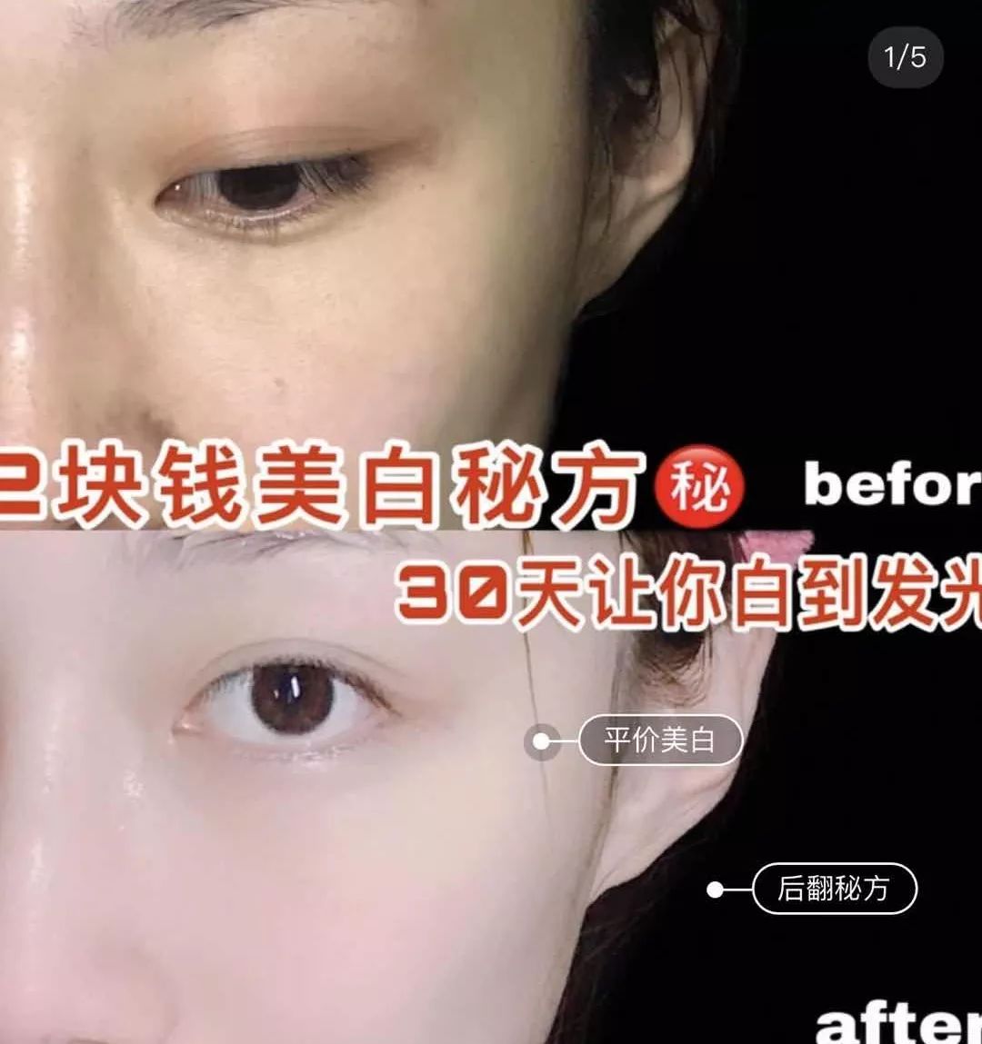 那些你不知道的护肤成分,不踩坑护肤的哪些成分不可忽略