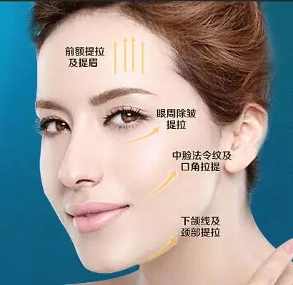 什么是线雕图片,什么是线雕线雕效果怎么样