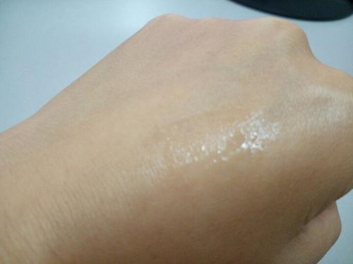 长了小小的脂肪粒怎么消除,长脂肪粒怎么处理最有效