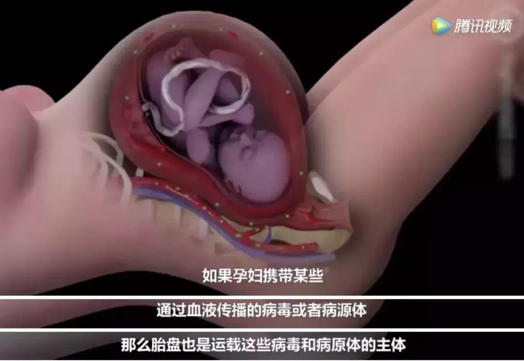 浜轰綋鑳庣洏淇℃伅,浜轰綋鑳庣洏鏄湡鐨勫悧