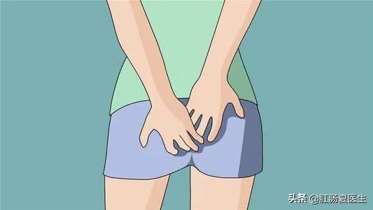 外痔疮有个肉球不痛就是会痒,痔疮不疼不痒属于外痔吗