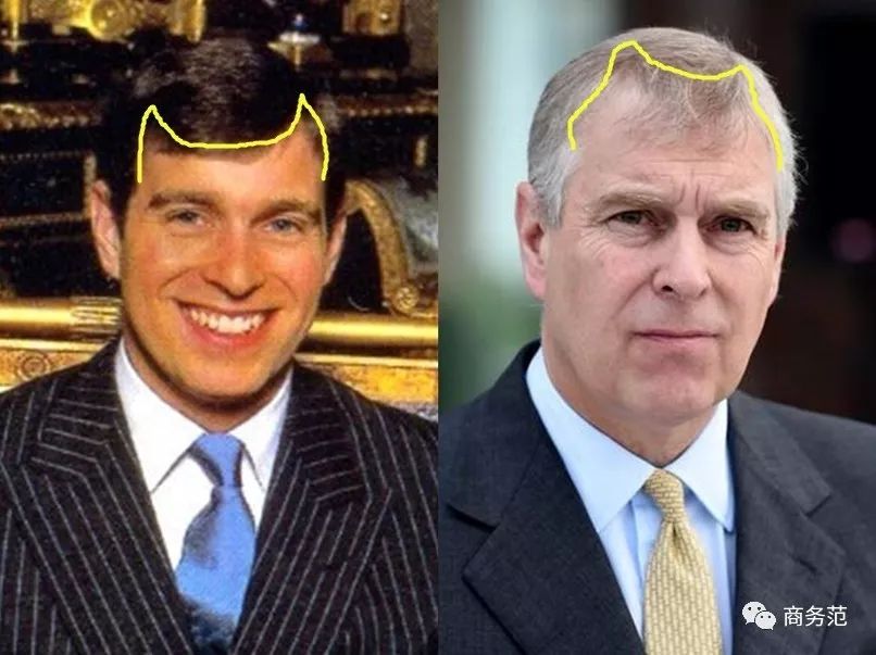 贝克汉姆脱发最新消息,大卫贝克汉姆脱发