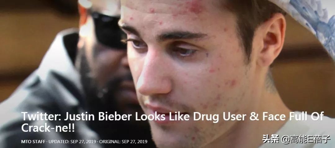 贾斯汀比伯浪了一圈归来还是少年,贾斯汀比伯晒自曝右脸面瘫