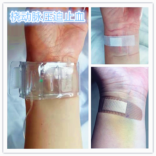 子宫肌瘤什么情况适合用介入栓塞,子宫肌瘤能做栓塞介入吗