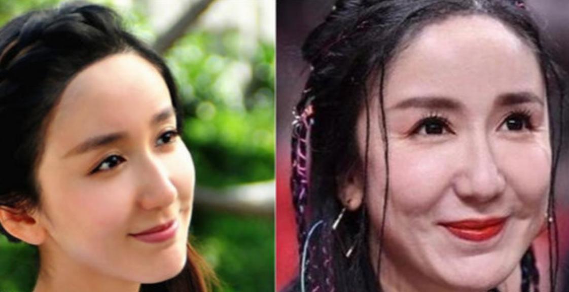 打玻尿酸显老网红,打玻尿酸成功的明星