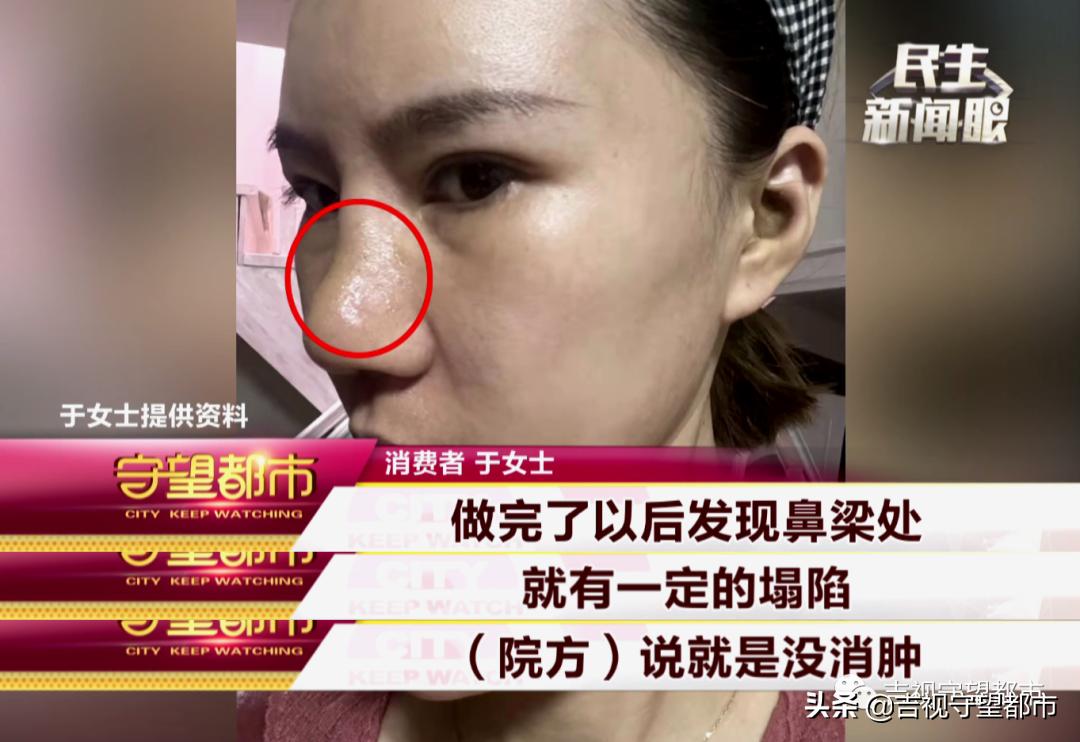 一万块可以做鼻综合吗,鼻综合半个月发现有点歪怎么办