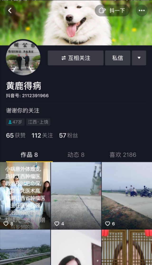 仁术！介入栓塞急诊止血，让患者转危为安