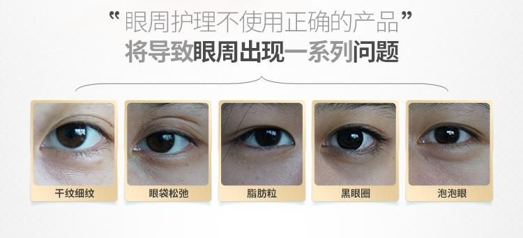 马伊琍资生堂玻尿酸微针眼膜,资生堂微针眼贴