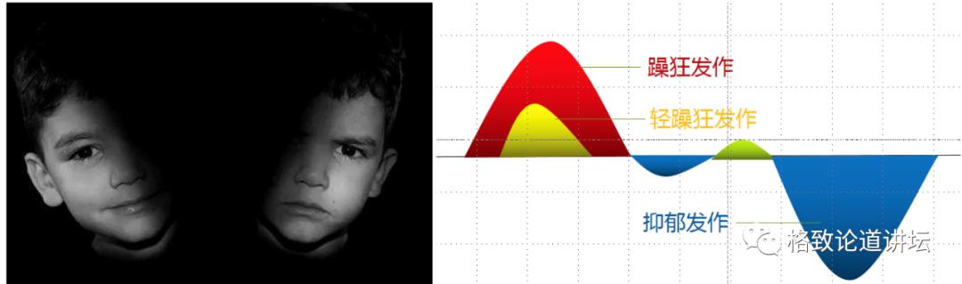 躁郁症心情转变原因,躁郁症的五大征兆和四大对策