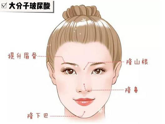 注射玻尿酸品牌十大排行榜,玻尿酸补水保湿推荐哪款