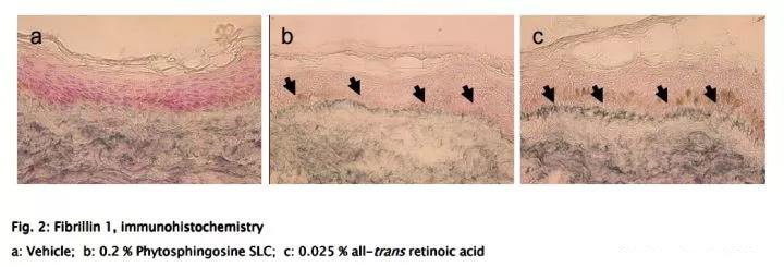 娇韵诗双萃精华熬夜精华,娇韵诗双萃精华效果前后对比图片