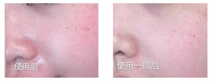 张馨予用的是什么眼霜,张馨予美致颜眼部精华乳