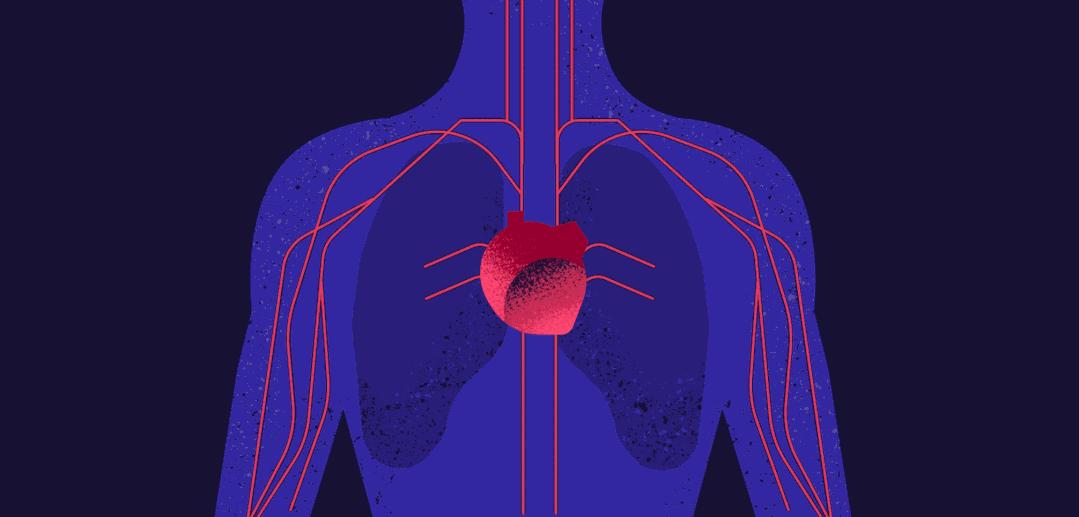 心血管病人眼睛肿怎么回事,心血管疾病引起眼皮水肿严重吗