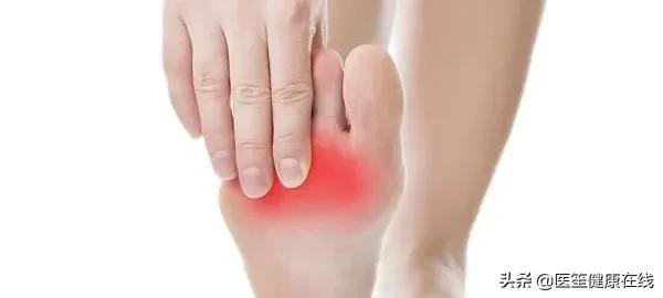 前脚掌老茧很疼,前脚掌起老茧怎么处理