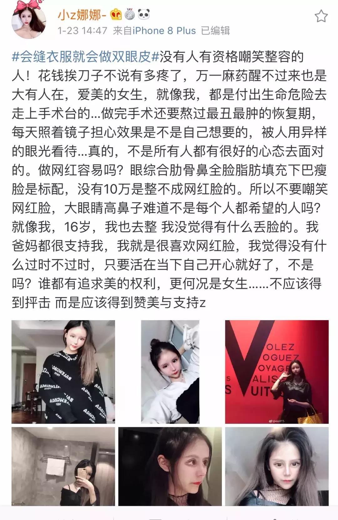 13岁开始整容,视李蒽熙为偶像!小Z娜娜是疯了吗?