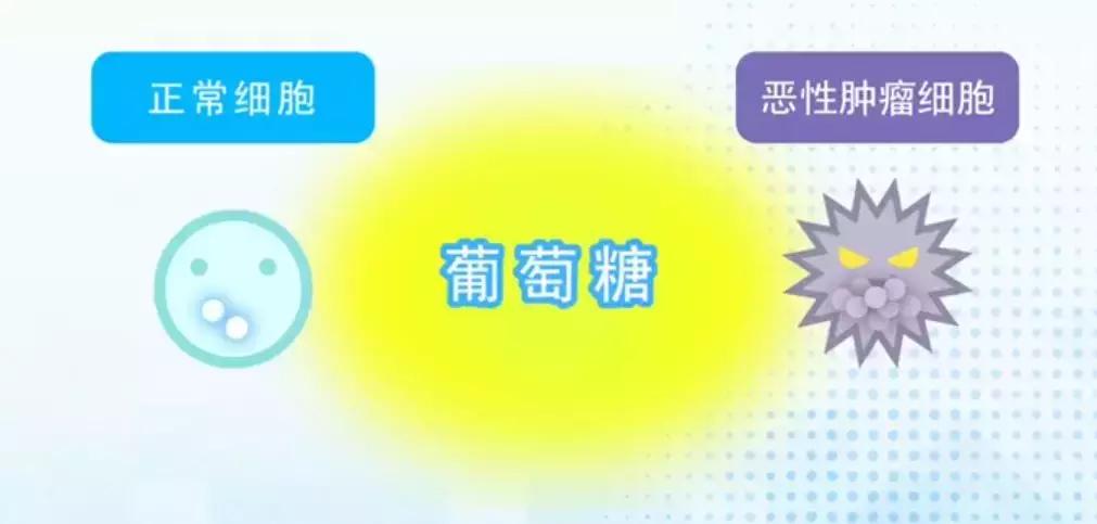 外国早期筛查癌症,petct用于诊断癌症