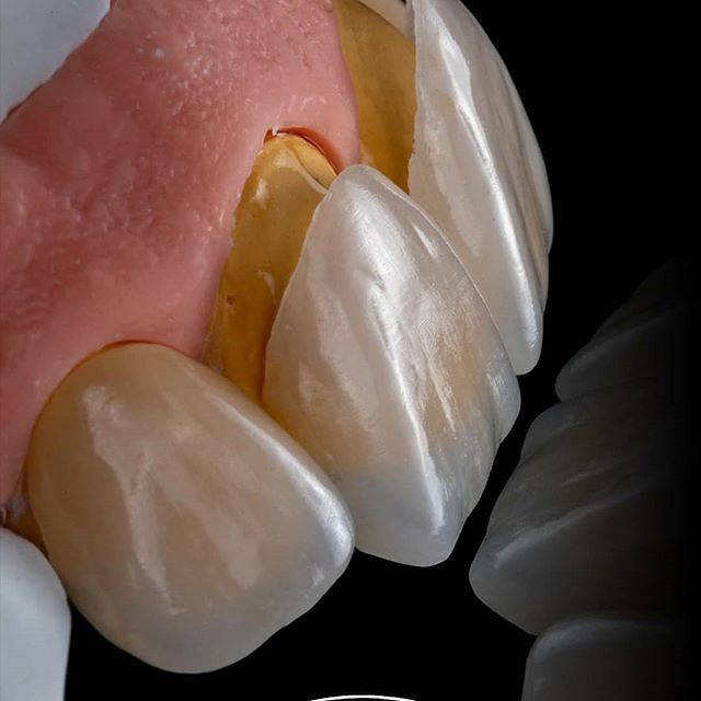 2023年女人最关注的问题,不要整容要整牙