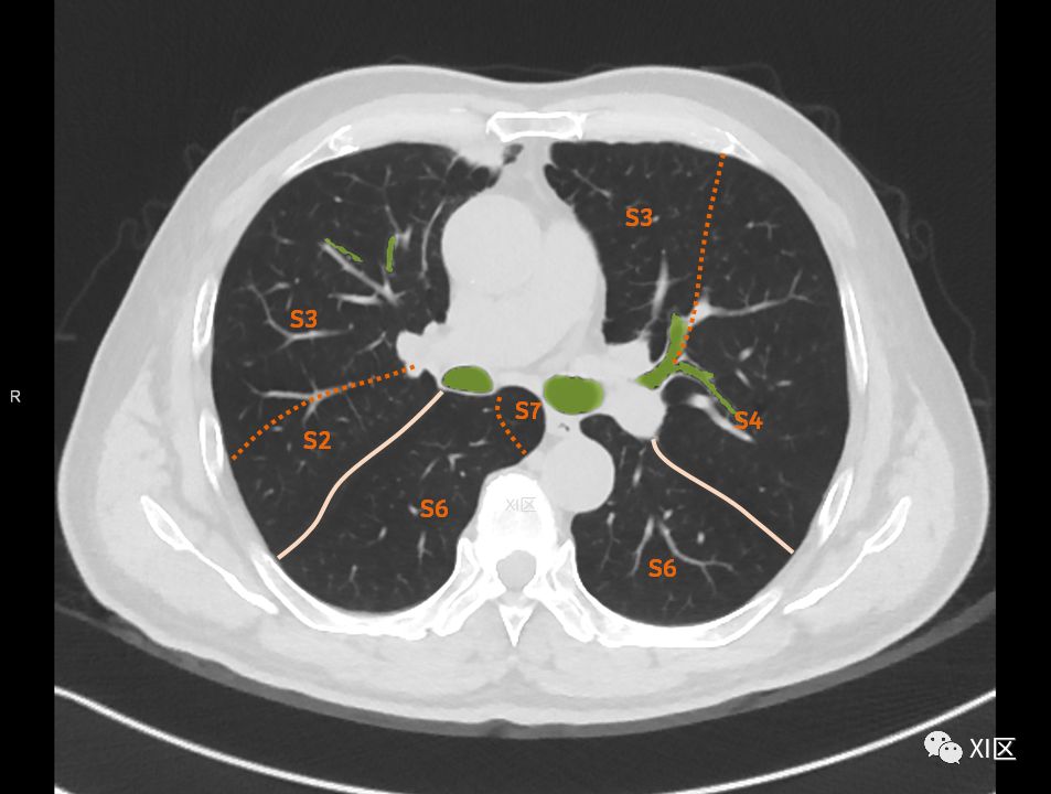 如此详细的肺部影像解剖，有点儿酷！