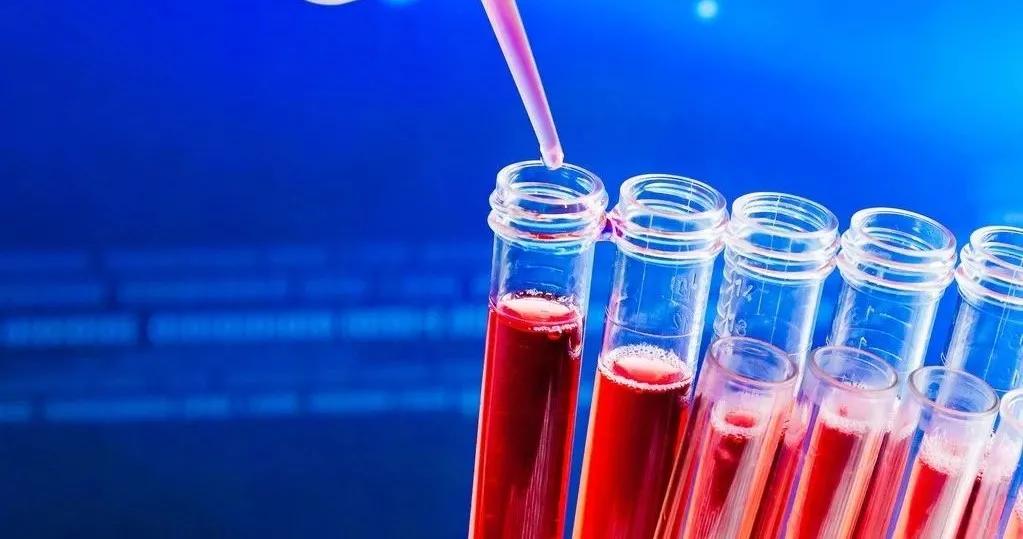 胆碱酯酶异常,胆碱酯酶异常怎么回事