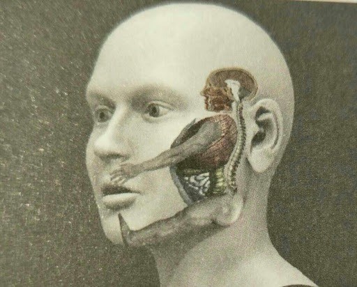 古派针灸，在欧洲治疗因痛经多次手术留下的后遗症