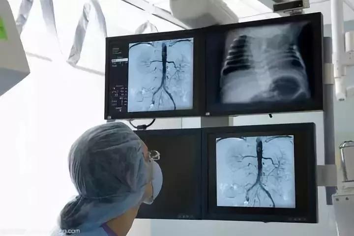 造影结果深度解析,造影过敏要多少时间出现症状