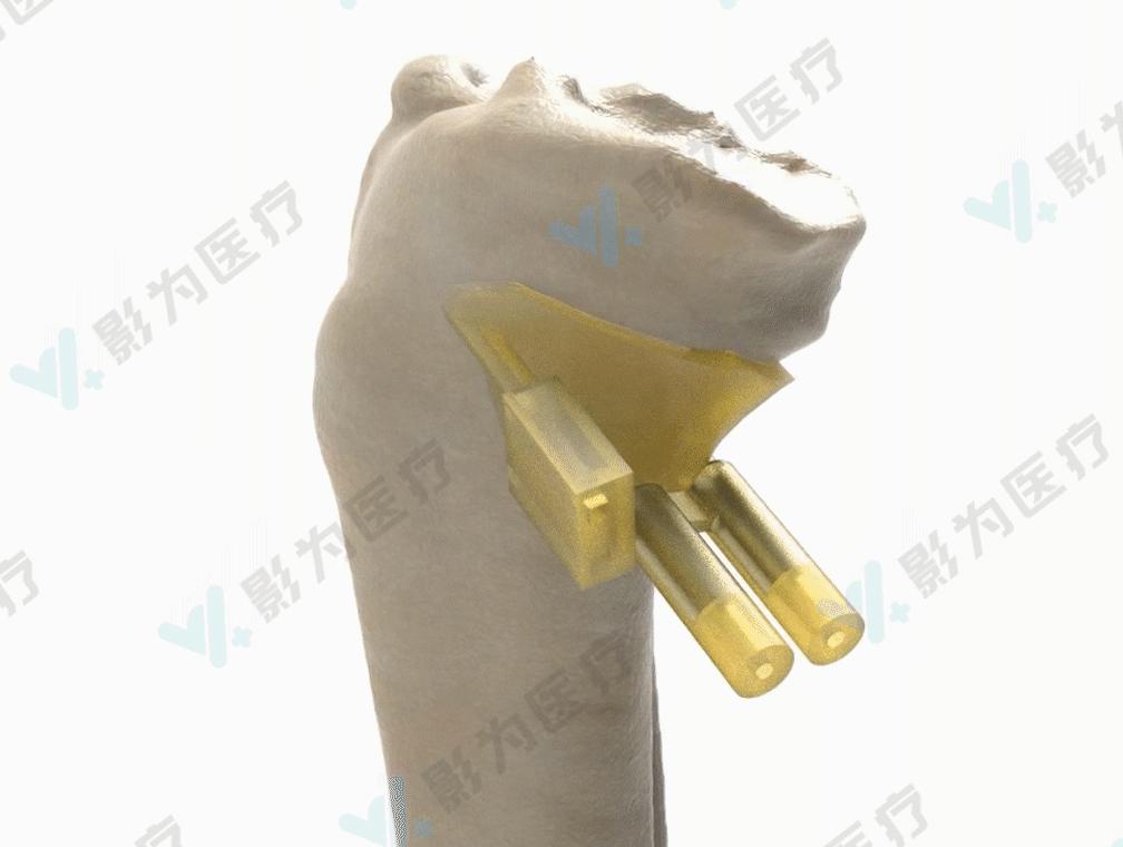 安医大阜阳附属医院减重,阜阳市颍州区安医大附属阜阳医院