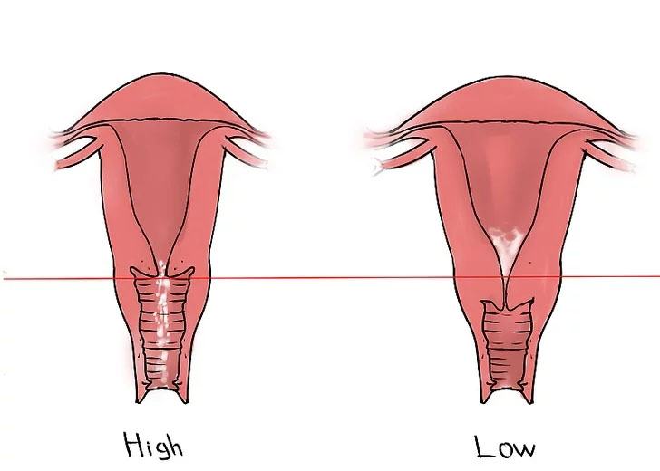外阴萎缩是怎么检查出来的,外阴萎缩是怎么导致