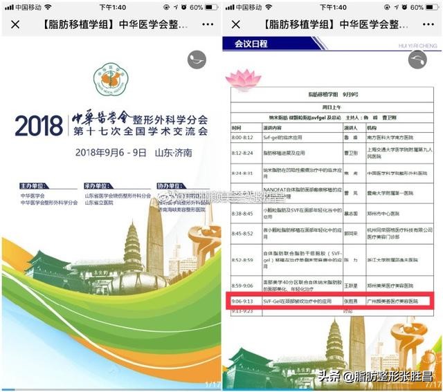 颈纹太多又显老，但常规方法祛除总是不能持久？做这个就可以了