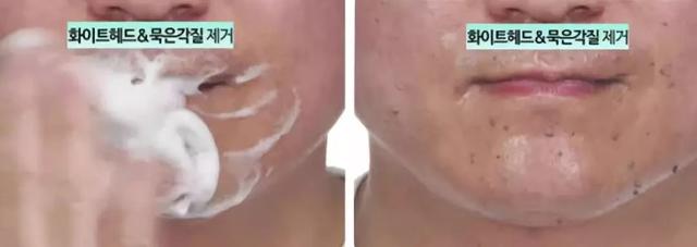 张韶涵推荐去角质视频,张韶涵出绝招